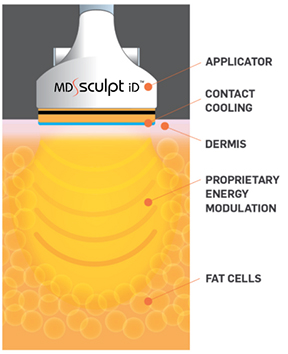 MD Sculpt ID